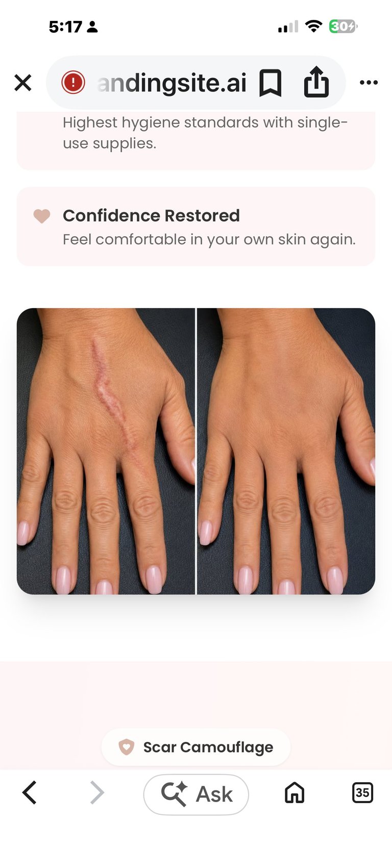 Before and after comparison of a hand showing scar treatment results on the back of the hand