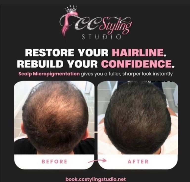 Before and after scalp micropigmentation results showing hair restoration on bald head at CC Styling Studio Bradenton FL