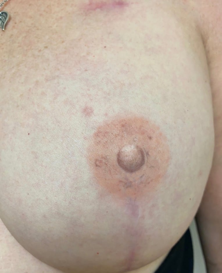 Close-up of human skin showing natural breast anatomy with areola and nipple