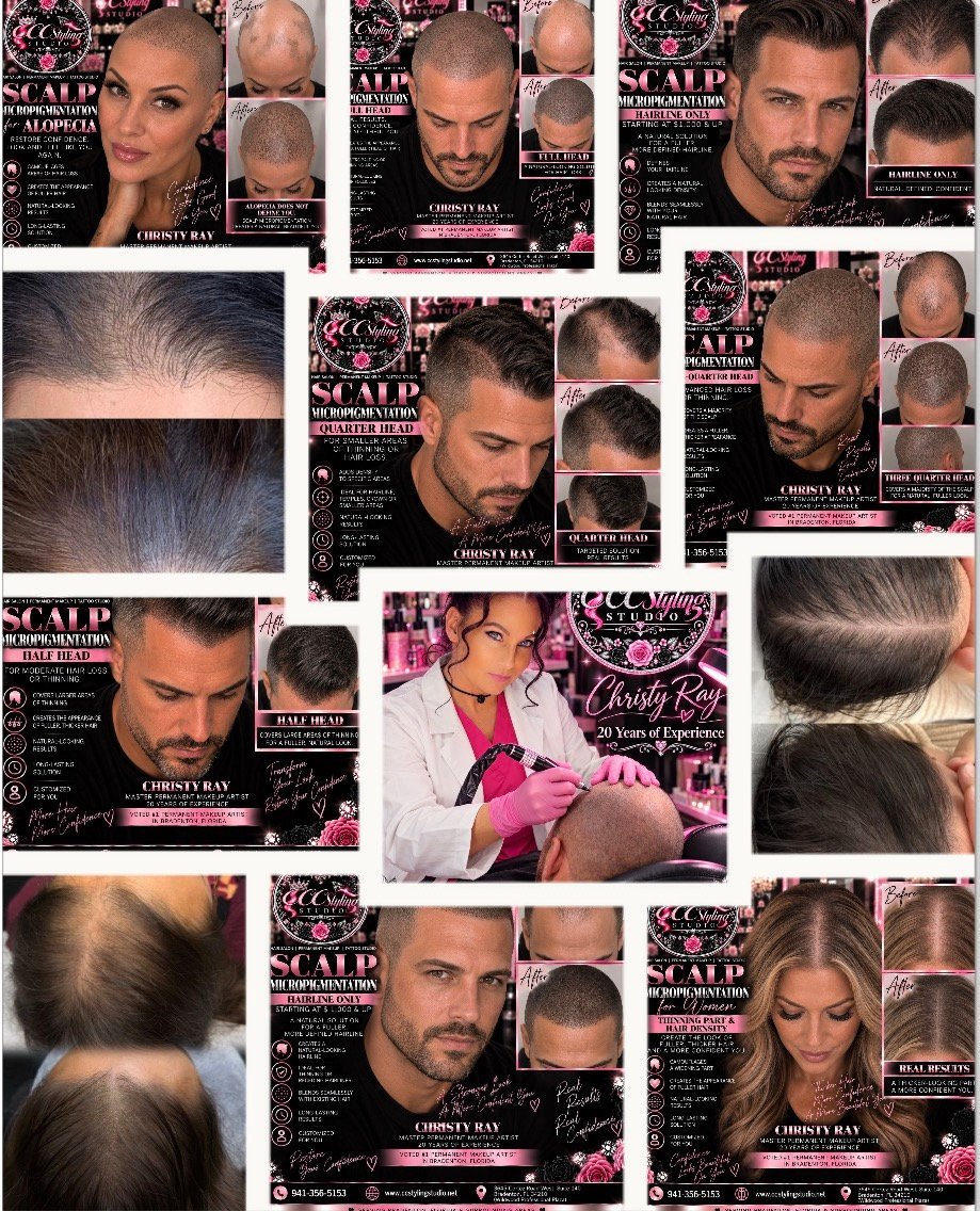 Collage of hair loss treatment before and after photos and promotional materials for Christy Raybould scalp services
