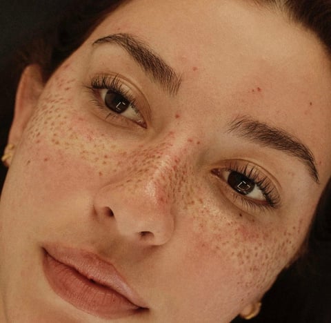 Close-up portrait of a person with freckles, natural makeup, and brown eyes looking at camera